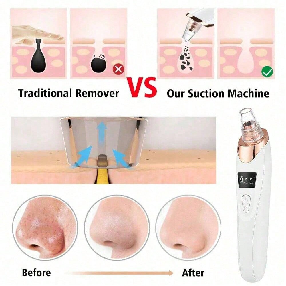 ZENTRO™ – Electric Acne Pore Cleaner & Blackhead Remover