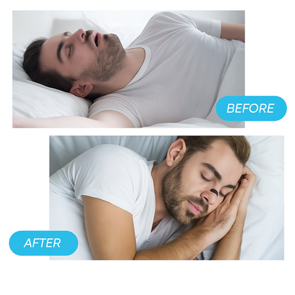 ZENTRO™-Sports Nasal Dilator
