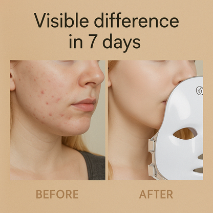 ZENTRO™-LED FACE GLOWING MASK